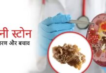 अगर आपको भी है ये दर्द, तो हो सकती है किडनी स्टोन, जानें लक्षण और बचाव के उपाय!